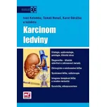 Karcinom ledviny - Ivan Kolombo
