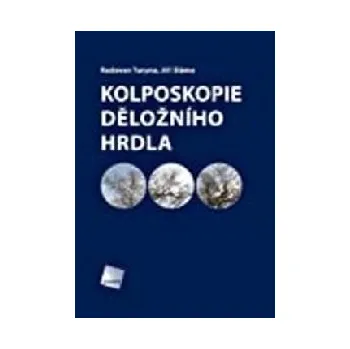 Kolposkopie děložního hrdla - Radovan Turyna, Jiří Sláma Kolposkopie děložního hrdla - Radovan Turyna, Jiří Sláma