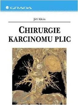 Kniha Chirurgie karcinomu plic - Jiří Klein [E-kniha] 