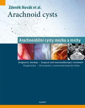 Arachnoid cysts: Arachnoidální cysty mozku a míchy - Zdeněk Novák