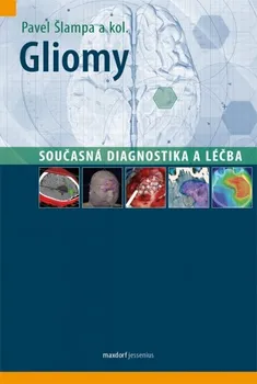 Gliomy: Současná diagnostika a léčba - Pavel Šlampa