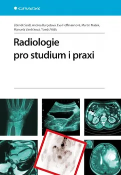 Radiologie pro studium i praxi - Zdeněk Seidl a kol.