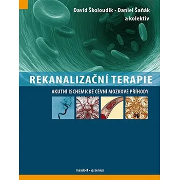 Rekanalizační terapie: Akutní…
