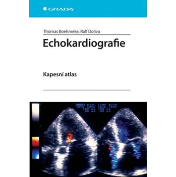 Echokardiografie - Thomas Boehmeke, Ralf Doliva