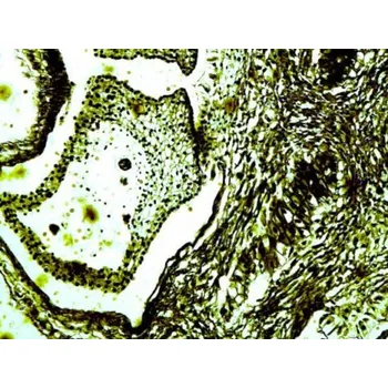 Dalekohled Mikroskopické preparáty - Život v půdě - KONUS Italy - KON 4950