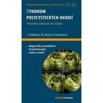 Syndrom polycystických ovarií - Jana Vrbíková, Michael Fanta, Dana Koryntová Syndrom polycystických ovarií - Jana Vrbíková, Michael Fanta, Dana Koryntová