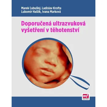 Doporučená ultrazvuková vyšetření v těhotenství - Marek Lubušký Doporučená ultrazvuková vyšetření v těhotenství - Marek Lubušký