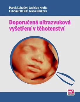 Doporučená ultrazvuková vyšetření v těhotenství - Marek Lubušký