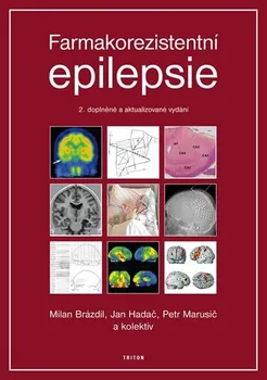 Farmakorezistentni epilepsie: 2. vydání - Brázdil Milan, Hadač Jan, Marusič Petr a kolektiv